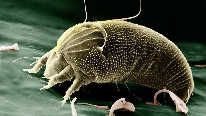 tungau debu wikipedia commons