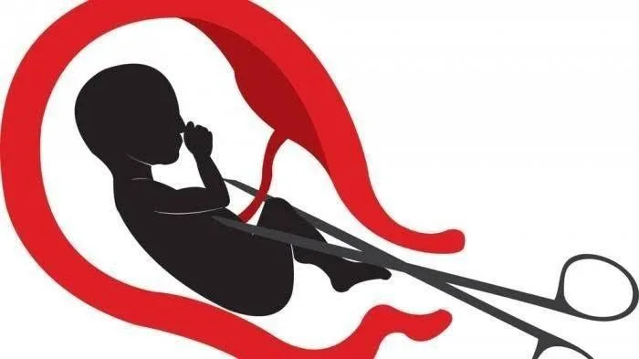 ilustrasi aborsi